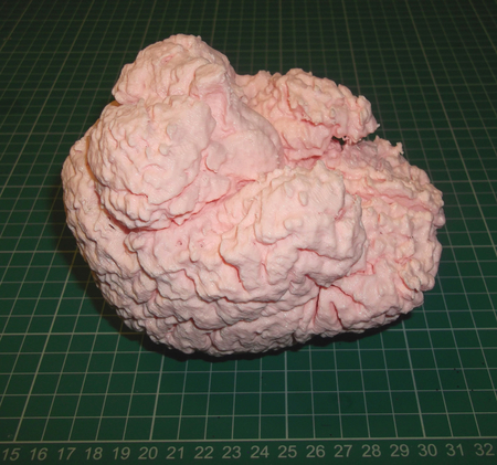 El Cerebro Humano